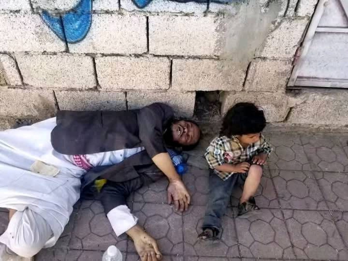 اليمن.. الموت جوعاً في وطن ممزق بالحرب رجلٌ جائع وطفلٌ يتيم.. وطنٌ يحتضر وضمائر ميتة